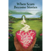 When Scars Become Stories: A Journey of Healing, Restoration & Faith