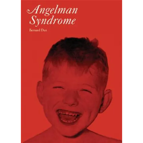 Angelman Syndrome