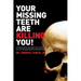 Your Missing Teeth Are Killing You!: The Devastating Consequences of Tooth Loss and the Life Changing Benefits of Dental Implants