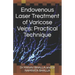 Endovenous Laser Treatment of Varicose Veins: Practical Technique