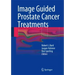 Image Guided Prostate Cancer Treatments
