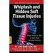 Whiplash and Hidden Soft Tissue Injuries: When, Where and Why to Refer Auto Accident Patients
