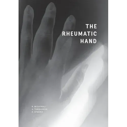 The Rheumatic Hand