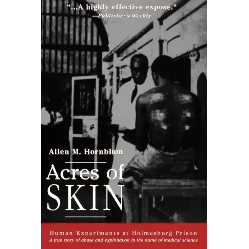 Acres of Skin: Human Experiments at Holmesburg Prison