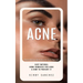Acne: Proven Natural Remedies for Acne-free Skin (Easy Natural Home Remedies for Acne & How to Prevent It)