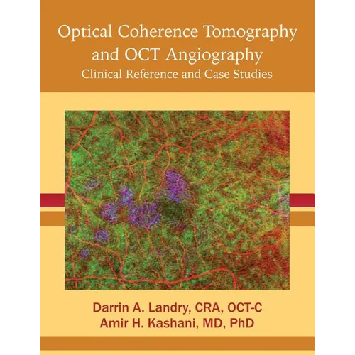 Optical Coherence Tomography and OCT Angiography: Clinical Reference and Case Studies