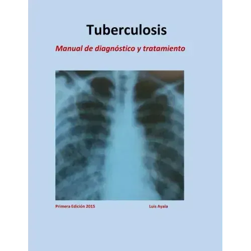 Tratamiento de Tuberculosis: Manual de diagnóstico y tratamiento