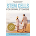 Stem Cells for Spinal Stenosis