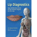 Lip Diagnostics: New Reflection Zones of the Human Organs on the Lips