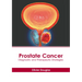 Prostate Cancer: Diagnostic and Therapeutic Strategies