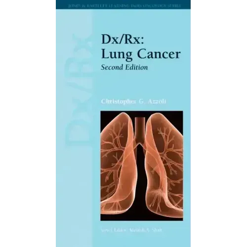 DX/Rx: Lung Cancer: Lung Cancer