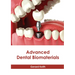 Advanced Dental Biomaterials