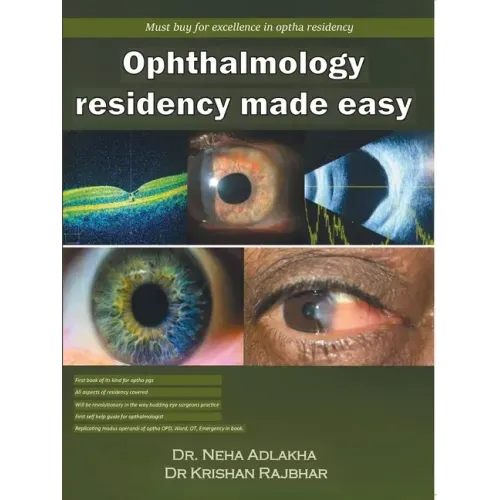 Ophthalmology Residency Made Easy
