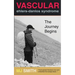 Vascular Ehlers-Danlos Syndrome: The Journey Begins