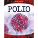 Polio