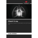 Chest X-ray