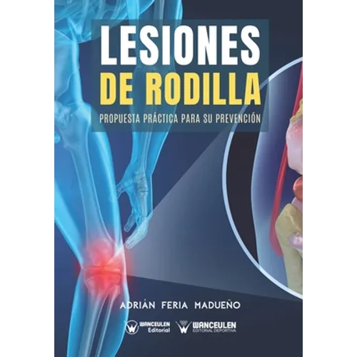 Lesiones de rodilla: Propuesta práctica para su prevención