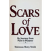 Scars of Love: My Journey from Pain to Purpose