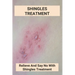 Shingles Treatment: Relieve And Say No With Shingles Treatment: Shingles On Face Treatment