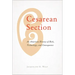 Cesarean Section: An American History of Risk, Technology, and Consequence