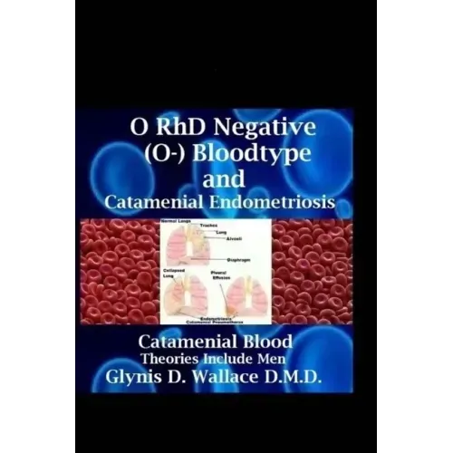 O RhD Negative (O-) Bloodtype And Catamenial Endometriosis: Catamenial Blood Theories Include Men