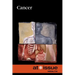 Cancer