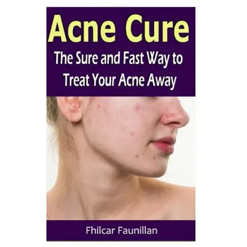 Acne Cure: The Sure and Fast Way to Treat Your Acne Away