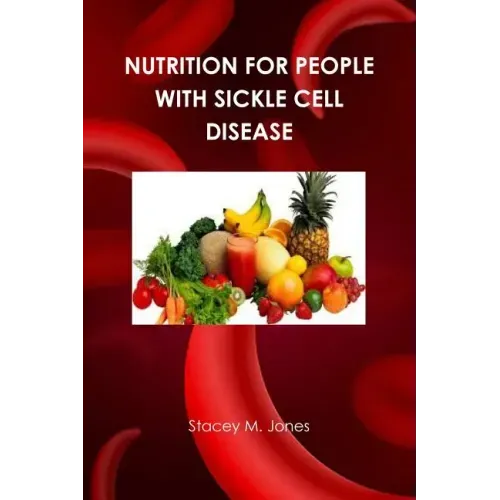 Nutrition for people with Sickle Cell Disease