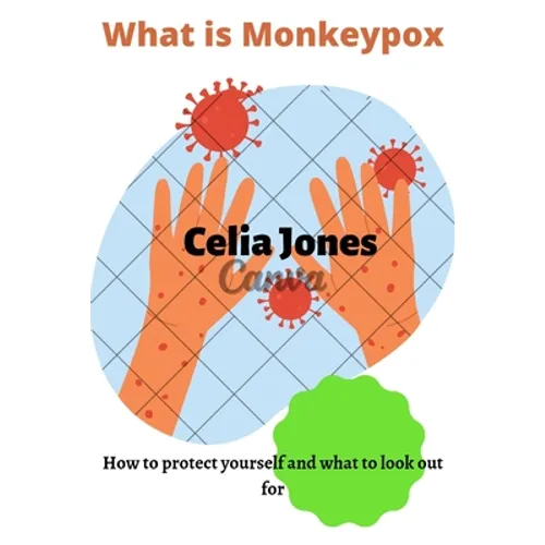 What Is Monkeypox: How to protect yourself and what to look out for. Guidelines for safety