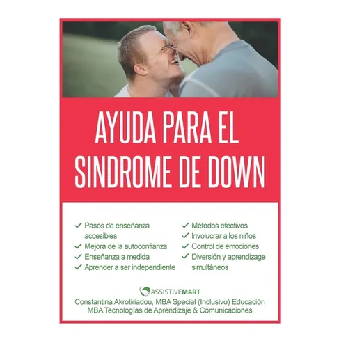Ayuda para el Sindrome de Down