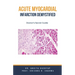 Acute Myocardial Infarction Demystified: Doctor's Secret Guide