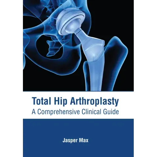 Total Hip Arthroplasty: A Comprehensive Clinical Guide