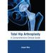 Total Hip Arthroplasty: A Comprehensive Clinical Guide