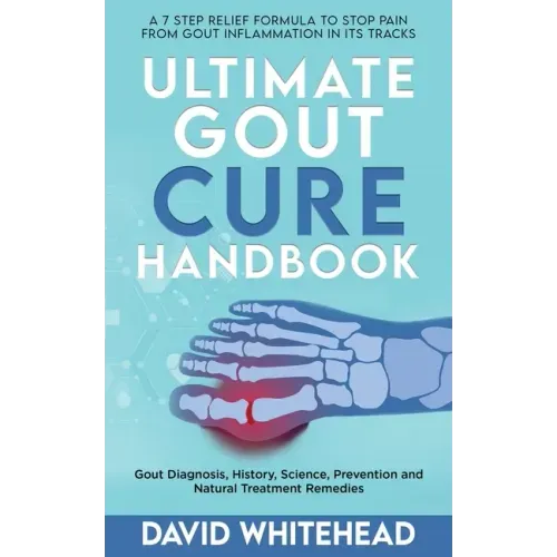 Ultimate Gout Cure Handbook: Gout Diagnosis, History, Science, Prevention and Natural Treatment Remedies