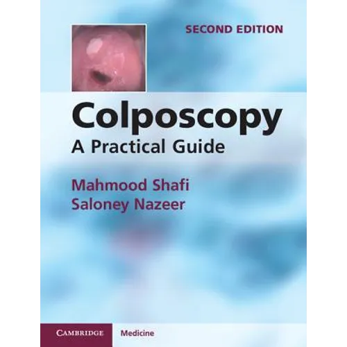 Colposcopy
