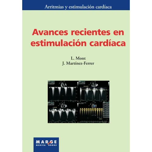Avances recientes en estimulación cardíaca