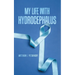 My Life with Hydrocephalus