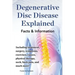 Degenerative Disc Disease Explained. Including Treatment, Surgery, Symptoms, Exercises, Causes, Physical Therapy, Neck, Back, Pain, and Much More! Fac