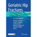 Geriatric Hip Fractures: A Practical Approach