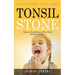 Tonsil Stones: The Truth about Tonsil Stones (Eliminate Tonsil Stones and Have Fresh Breath in Just Days!)