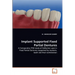 Implant Supported Fixed Partial Dentures