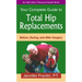 Your Comp GT Total Hip Replace: Before, During, and After Surgery