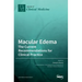 Macular Edema: The Current Recommendations for Clinical Practice