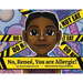 No, Renee, You are Allergic!