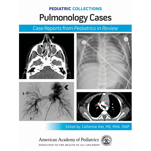 Pediatric Collections: Pulmonology Cases: Case Reports from Pediatrics in Review - Paperback
