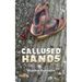 Callused Hands