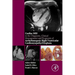 Cardiac MRI in Diagnosis, Clinical Management, and Prognosis of Arrhythmogenic Right Ventricular Cardiomyopathy/Dysplasia
