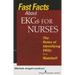 Fast Facts About EKGs for Nurses: The Rules of Identifying EKGs in a Nutshell