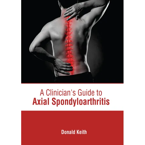 A Clinician's Guide to Axial Spondyloarthritis - Hardcover