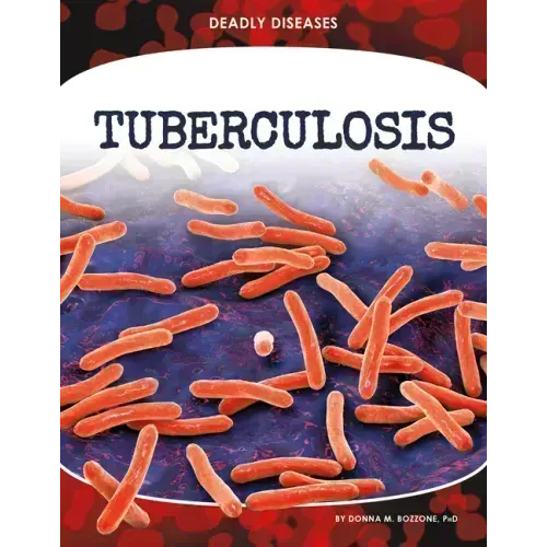 Tuberculosis